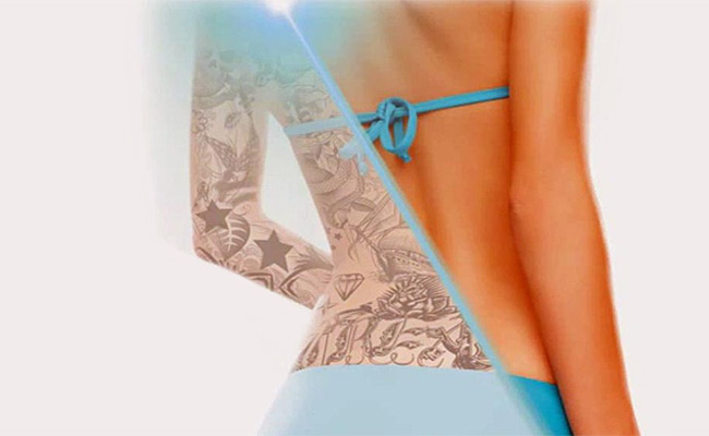 intro tattoo removal